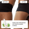 Advanced Stretch Mark Removal Cream